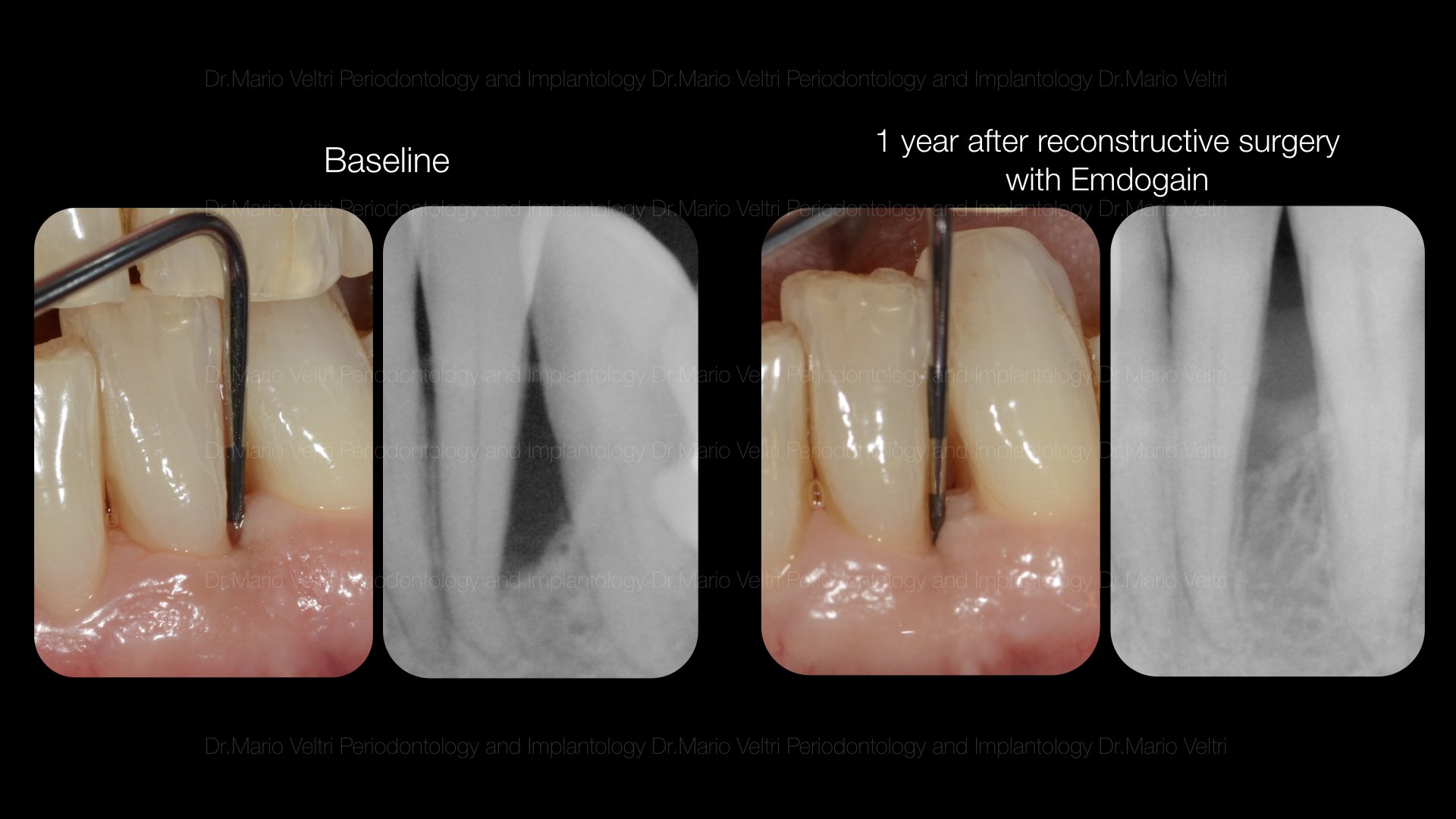 reconstructive for pat.001